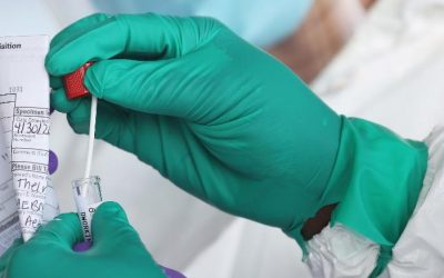 Long Covid is a bigger problem than we thought